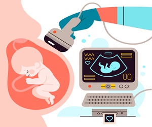 Ultrasound Scan